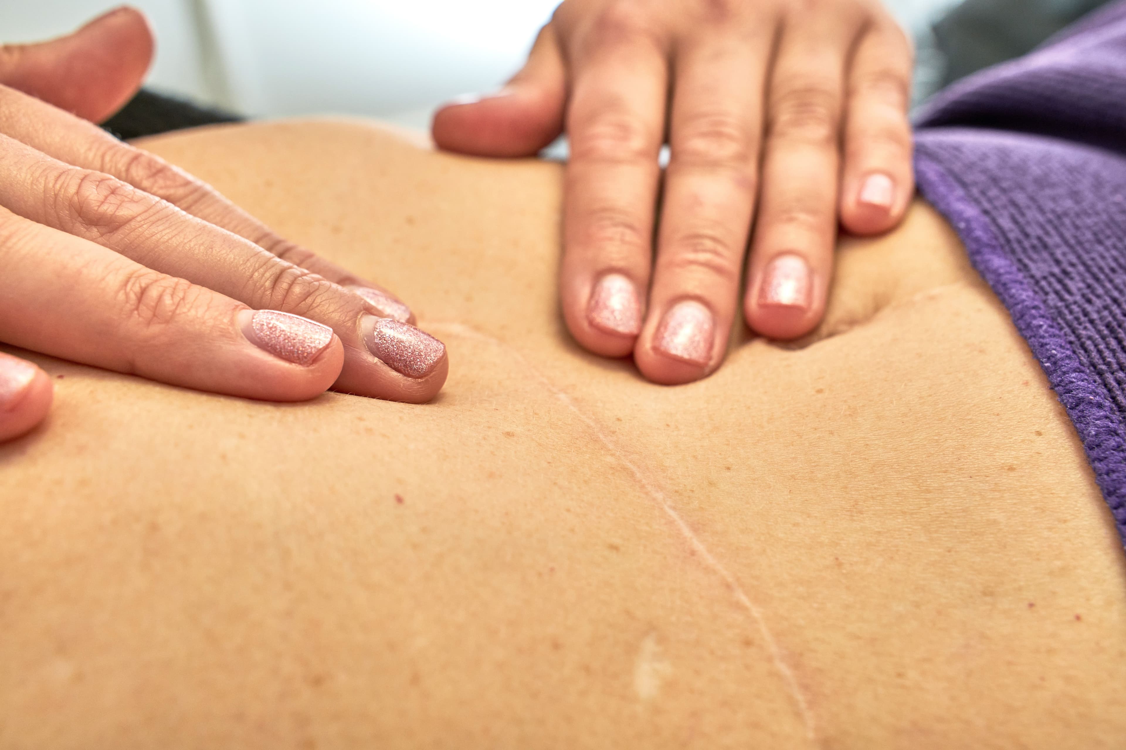 Header image for the article “How Scar therapy massage could help you!”
